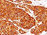 Tyrosinase (Melanoma Marker) Antibody in Immunohistochemistry (Paraffin) (IHC (P))