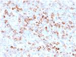 Tyrosinase Antibody in Immunohistochemistry (Paraffin) (IHC (P))