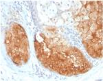 Tyrosinase (Melanoma Marker) Antibody in Immunohistochemistry (Paraffin) (IHC (P))