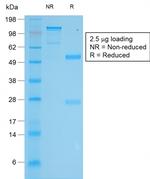 Tyrosinase Antibody in SDS-PAGE (SDS-PAGE)