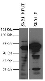 PRMT5 Antibody in Immunoprecipitation (IP)