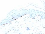 Tyrosinase-Related Protein-1 (TYRP-1) (Melanoma Marker) Antibody in Immunohistochemistry (Paraffin) (IHC (P))