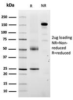 Tyrosinase-Related Protein-1 (TYRP-1) (Melanoma Marker) Antibody in SDS-PAGE (SDS-PAGE)