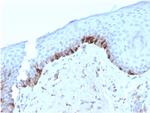 Tyrosinase-Related Protein-1 (TYRP-1) Antibody in Immunohistochemistry (Paraffin) (IHC (P))