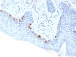 Tyrosinase-Related Protein-1 (TYRP-1) (Melanoma Marker) Antibody in Immunohistochemistry (Paraffin) (IHC (P))