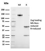 Tyrosinase-Related Protein-1 (TYRP-1) Antibody in SDS-PAGE (SDS-PAGE)