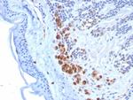 Tyrosinase-Related Protein-1 (TYRP-1) (Melanoma Marker) Antibody in Immunohistochemistry (Paraffin) (IHC (P))