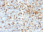 Tyrosinase-Related Protein-1 (TYRP-1) (Melanoma Marker) Antibody in Immunohistochemistry (Paraffin) (IHC (P))