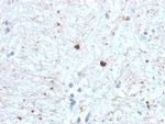 Ubiquitin Antibody in Immunohistochemistry (Paraffin) (IHC (P))