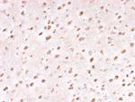 Ubiquitin Antibody in Immunohistochemistry (Paraffin) (IHC (P))