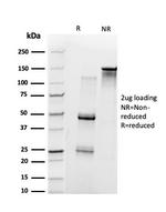 UBE3A/E6-AP Antibody in SDS-PAGE (SDS-PAGE)
