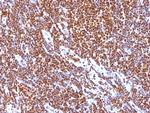 SUMO-1 Antibody in Immunohistochemistry (Paraffin) (IHC (P))