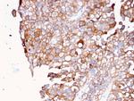 Uroplakin 1B Antibody in Immunohistochemistry (Paraffin) (IHC (P))