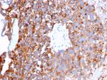 Uroplakin 1B Antibody in Immunohistochemistry (Paraffin) (IHC (P))