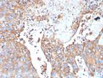 Uroplakin 1B Antibody in Immunohistochemistry (Paraffin) (IHC (P))