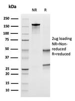 Uroplakin 1B Antibody in SDS-PAGE (SDS-PAGE)