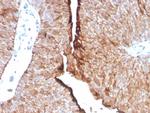 Uroplakin 1B (Urothelial Differentiation Marker) Antibody in Immunohistochemistry (Paraffin) (IHC (P))