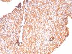 Uroplakin 1B (Urothelial Differentiation Marker) Antibody in Immunohistochemistry (Paraffin) (IHC (P))