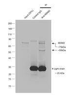 MDM2 Antibody in Immunoprecipitation (IP)