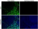 Ki-67 Antibody in Immunohistochemistry (Paraffin) (IHC (P))