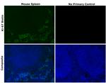 Ki-67 Antibody in Immunohistochemistry (Paraffin) (IHC (P))