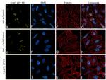 Ki-67 Antibody in Immunocytochemistry (ICC/IF)