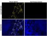 Ki-67 Antibody in Immunohistochemistry (Paraffin) (IHC (P))