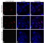 Ki-67 Antibody in Immunocytochemistry (ICC/IF)