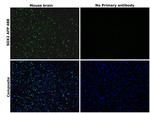 SOX2 Antibody in Immunohistochemistry (Paraffin) (IHC (P))