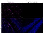 SOX2 Antibody in Immunohistochemistry (Paraffin) (IHC (P))