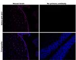 SOX2 Antibody in Immunohistochemistry (Paraffin) (IHC (P))