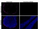 SOX2 Antibody in Immunohistochemistry (Paraffin) (IHC (P))