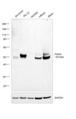 Parkin Antibody in Western Blot (WB)