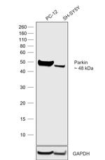 Parkin Antibody in Western Blot (WB)