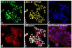 GATA-3 Antibody in Immunocytochemistry (ICC/IF)