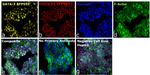 GATA-3 Antibody