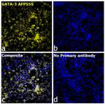 GATA-3 Antibody in Immunocytochemistry (ICC/IF)