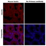 CD276 (B7-H3) Antibody in Immunohistochemistry (Paraffin) (IHC (P))