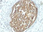 VEGF (Vascular Endothelial Growth Factor) Antibody in Immunohistochemistry (Paraffin) (IHC (P))