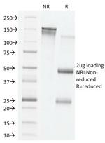VEGF (Vascular Endothelial Growth Factor) Antibody in SDS-PAGE (SDS-PAGE)