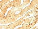 Villin (GI-Mucosal and Urogenital Brush Border Marker) Antibody in Immunohistochemistry (Paraffin) (IHC (P))