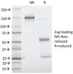 Villin (GI-Mucosal and Urogenital Brush Border Marker) Antibody in SDS-PAGE (SDS-PAGE)