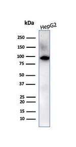 Villin (GI-Mucosal and Urogenital Brush Border Marker) Antibody in Western Blot (WB)