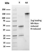 VLDL-Receptor (Very Low Density Lipoprotein Receptor) Antibody in Immunoelectrophoresis (IE)