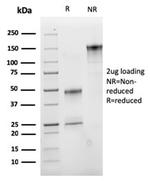 VLDL-Receptor (Very Low Density Lipoprotein Receptor) Antibody in SDS-PAGE (SDS-PAGE)