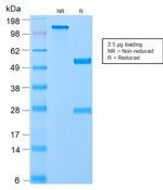 VLDL-Receptor (Very Low Density Lipoprotein Receptor) Antibody in SDS-PAGE (SDS-PAGE)