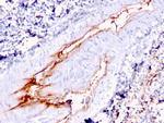 von Willebrand Factor/Factor VIII Related-Ag (Endothelial Marker) Antibody in Immunohistochemistry (Paraffin) (IHC (P))