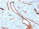 von Willebrand Factor/ Factor VIII Related-Ag (Endothelial Marker) Antibody in Immunohistochemistry (Paraffin) (IHC (P))