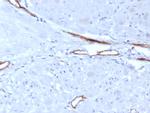von Willebrand Factor/Factor VIII Related-Ag (Endothelial Marker) Antibody in Immunohistochemistry (Paraffin) (IHC (P))