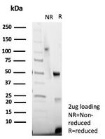 von Willebrand Factor/Factor VIII Related-Ag (Endothelial Marker) Antibody in SDS-PAGE (SDS-PAGE)